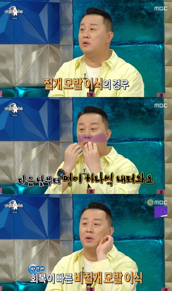 Jeong Jun-ha has shared her experiences from hair careGraft to scalp tattoos.Jung Jun-ho, Jeong Jun-ha, Yoon Hyun-min, and Yura appeared on MBC  ⁇  Radio Star  ⁇  broadcast on September 27th.On the day of the broadcast, Gim Gu-ra praised Yura for having a lot of hair, and Yura thought it was bad when she was young, and she pushed it all, but it was precious.When Gim Gu-ra said, People who fly are not good at it, Jeong Jun-ha said, I have done a  ⁇   ⁇  incision and an incision. Hair care Graft.When Jeong Jun-ha had a single-incision hair care graft, if you staple the plate, the bruise comes down. It is inactive. Non-incision does not matter if you work a few hours after planting.I thought I was going to shave for a long time, but I regret it. I had to cover it up with makeup.