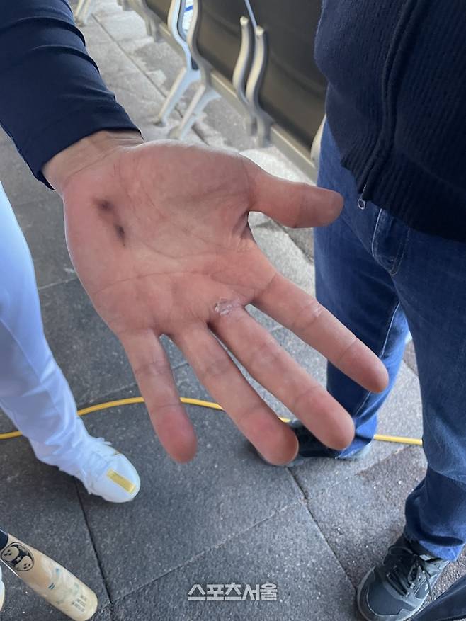 APBC 대표팀 최준용이 7일 대구삼성라이온즈파크에서 열린 소집훈련에서 굳은살이 박힌 손을 보여주고 있다. 대구 | 김동영기자 raining99@sportsseoul.com