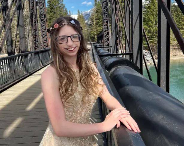 트리처 콜린스 증후군을 앓고 있는 아나 크리자노프스키의 모습./사진=더 선 캡처