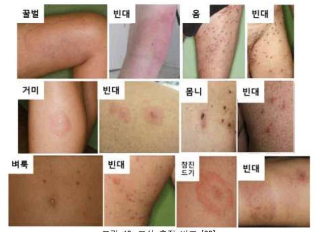 빈대와 다른 곤충들에게 물렸을 경우 나타나는 피부병변 비교. 빈대 정보집 개정판 캡처