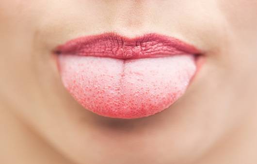 혀의 색깔에 따라 건강 상태를 파악할 수 있다ㅣ출처: 게티이미지뱅크