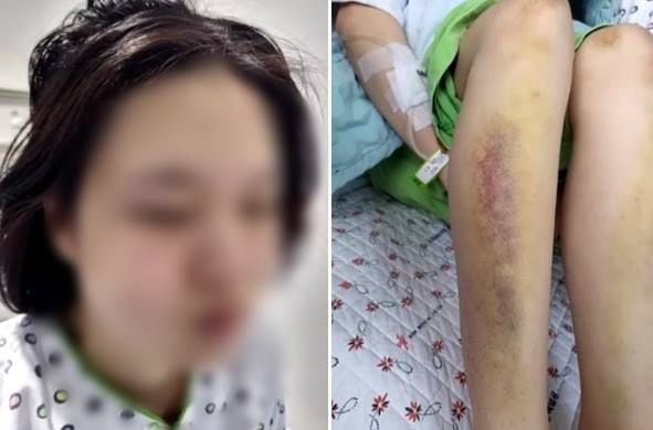 전 남자친구의 폭행으로 병원에서 입원 치료를 받던 중 숨진 20대 여성./JTBC