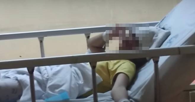필리핀 GMA뉴스는 마닐라에 거주 중이던 세라스페(13)가 이달 초 필리핀의 한 지역 병원으로 이송됐으나 사망했다고 보도했다. / 사진= GMA뉴스