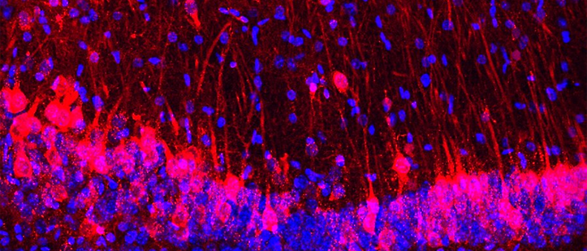 생쥐의 뇌 해마에서 시궁쥐 신경세포(붉은색)가 자란 모습./미 컬럼비아대