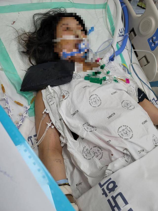 2020년 12월 8일 출산 직후 찾아온 호흡곤란으로 생사의 기로에 섰던 가윤선(33)씨가 고대구로병원에서 에크모 장치를 부착한 모습. 가윤선씨 제공