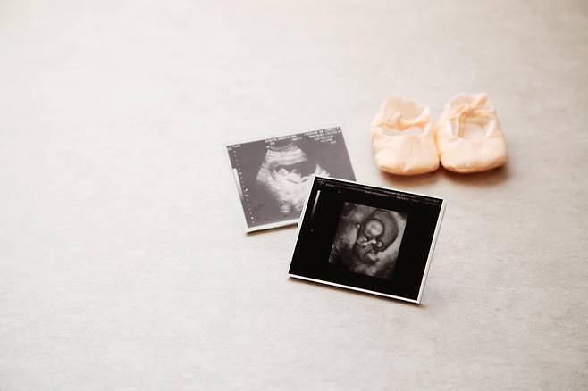 대체출산율(2.1명)까진 어렵겠지만, 조금이라도 출산율을 끌어올릴 수는 있지 않을까. 게티이미지