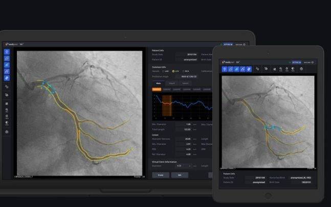 메디픽셀이 개발한 인공지능(AI) 기반 심혈관 진단 소프트웨어로 심혈관 조영술 영상을 분석한 모습./메디픽셀