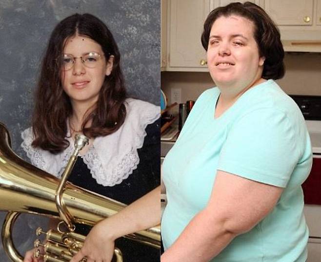 슈핑은 신체통합정체성장애 때문에 6세 때부터 자신이 시작장애인이어야 한다는 욕구를 느꼈다. 학생 시절 사진과 시력을 잃은 현재 모습/사진=영국 데일리메일