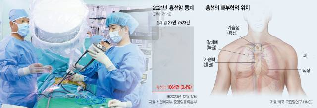 이희성(왼쪽) 한림대동탄성심병원 심장혈관흉부외과 교수가 최신 단일공 로봇수술기인 다빈치SP(Single Port)를 이용해 흉선종 수술을 시행하고 있다. 사진 제공=한림대동탄성심병원