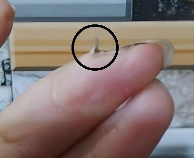 18세 여성에게 후천적 이소성 손톱이 발생한 사례./사진=국제외과사례보고저널