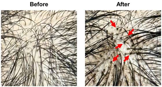폴리페놀이 단백질에만 달라붙는다는 모습을 보여주는 실험. 폴리페놀 팩토리