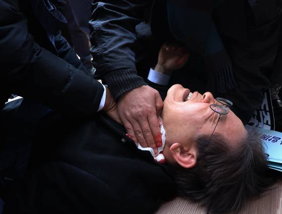 2024년 1월 2일 더불어민주당 이재명 대표가 부산 가덕도 신공항 부지를 둘러본 후 기자들과 문답을 진행하던 중 왼쪽 목 부위에 습격을 당해 피를 흘린 채 쓰러진 모습. 연합뉴스