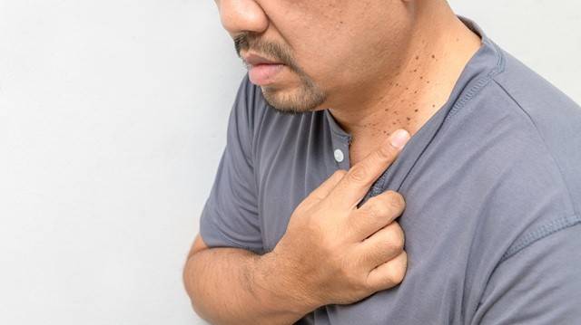 편평사마귀는 점처럼 보일 수 있지만, 순식간에 주변 부위로 퍼지는 특징이 있다|출처: 게티이미지뱅크