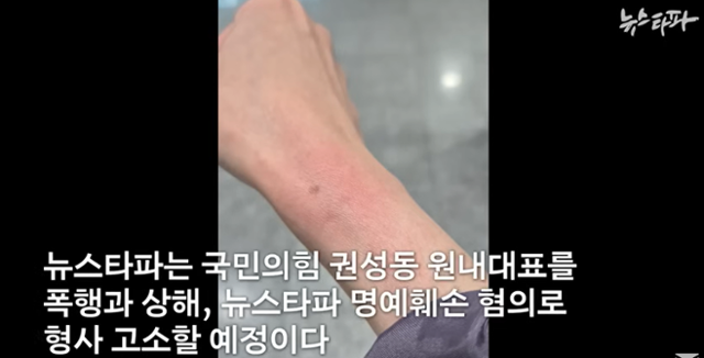 16일 권성동 국민의힘 원내대표에게 손목을 잡힌 채 끌려간 뉴스타파 기자가 빨갛게 변한 자신의 손목을 보여 주고 있다. 뉴스타파 유튜브 캡처