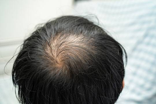 기사 내용과 관련 없음. 게티이미지뱅크