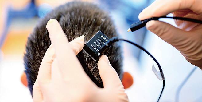 신경세포에서 나온 신호는 정수리에 있는 포트를 통해 외부 컴퓨터로 전송되고 AI가 이를 음성으로 구현한다. /UCSF