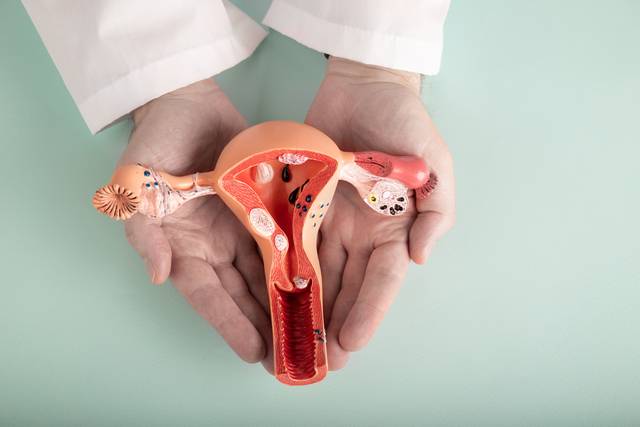 난소암 환자의 재발 여부를 예측할 수 있는 인자를 발견한 연구 결과가 나왔다. 사진은 기사의 특정 사실과 관련 없음. 게티이미지뱅크