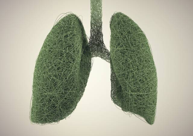 무기폐 상태의 폐 모습을 3D모델로 구현하는 기술이 개발됐다. 사진은 기사의 특정 사실과 관련 없음. 게티이미지뱅크