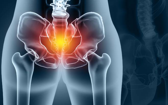 자궁, 방광, 직장 등 장기가 질 밖으로 탈출하는 ‘골반장기탈출증’ 환자가 고령화에 급속도로 늘고 있다. 게티이미지뱅크