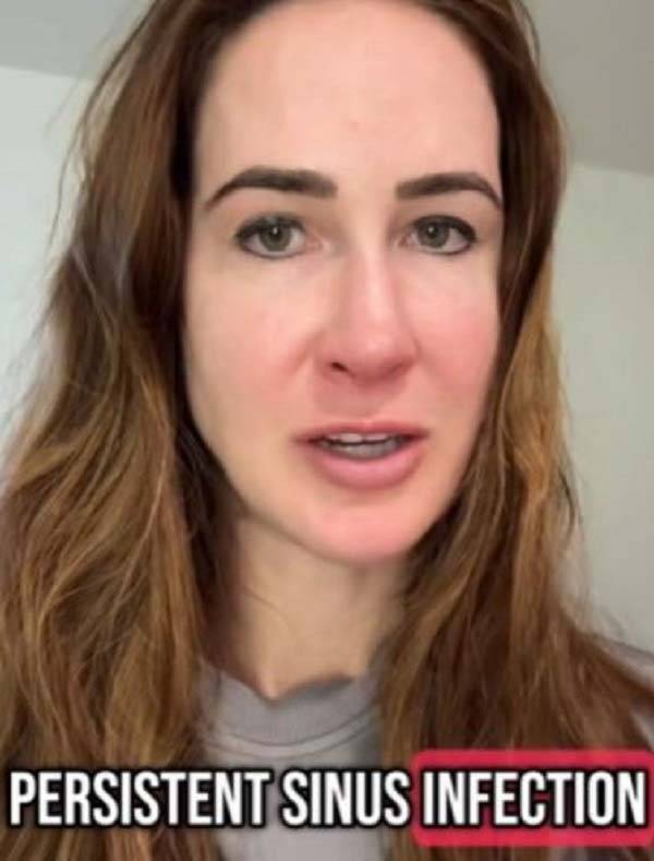 영국의 한 여성이 전 남자친구의 방귀로 호흡기질환을 앓고 있다고 밝힌 사연이 화제다./사진=더 선