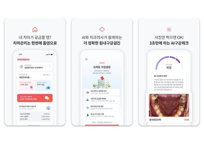 AI 기반 홈 구강검진 앱 홈덴 / 출처=아이클로