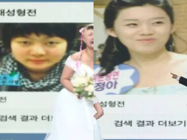 박나래와 장도연의 성형 전 모습이 공개됐다. KBS2 '개그콘서트' 방송화면 캡처.