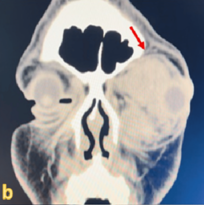사진=Cureus 캡처.