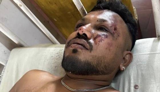 12일(현지시간) 인도 서부 구자라트주 아마다바드에 발생한 에어인디아 항공기 추락 사고의 유일한 생존자인 비슈와시 쿠마크 라메시. <출처=힌두스탄타임스 기사 갈무리>