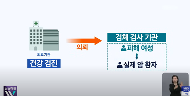 16일 KBS 등 방송사에는 지난해 유방암을 진단받아 수술했지만 다른 환자의 검체와 바뀌어 유방암이 아니었다는 여성의 사연이 보도됐다. KBS News 캡처