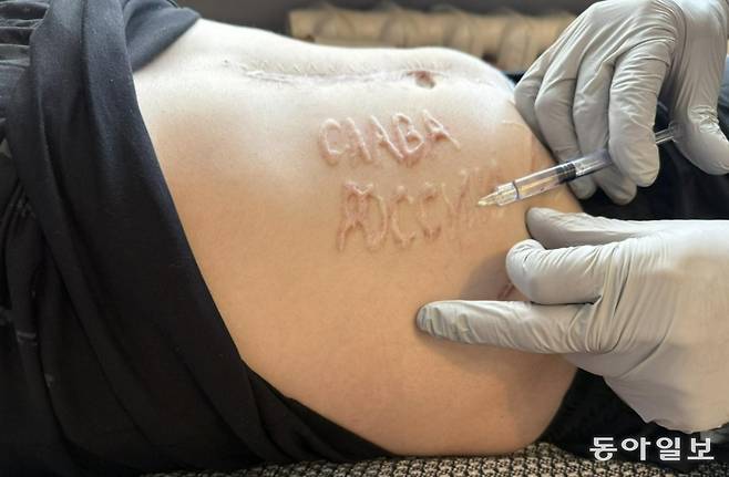 러시아에 포로로 잡혔다가 석방된 우크라이나 군인의 배에 ‘러시아에 영광을’이라는 글귀가 새겨져 있다. 페이스북 캡처