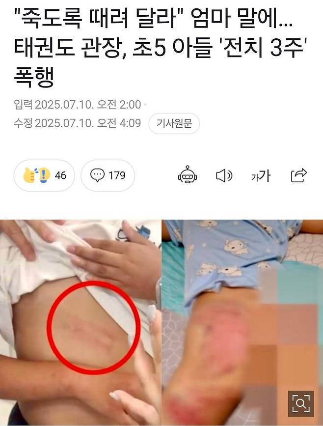 Screenshot_20250710_095144_NAVER.jpg "죽도록 때려달라" 엄마 말에 태권도 관장 초5 아이 전치 3주 폭행..