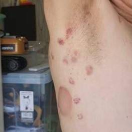 중국의 한 남성이 미용실에서 8억 여 원을 쓰며 관장, 디톡스 치료를 받은 것으로 알려졌다. 출처 광밍망