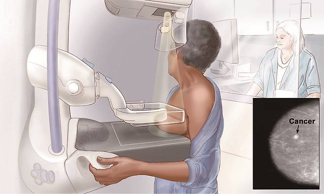 X선은 밀도가 높은 곳은 잘 지나가지 못해 영상에서 희게 나온다. 기존 유방암 검사에선 가슴을 아래위에서 압박하고 X선을 쏘아 칼슘이 쌓인 암 조직이 영상에서 하얗게 보이도록 한다(작은 사진). /사진 미 국립암연구소