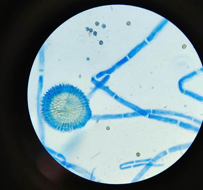 현미경으로 본 세균