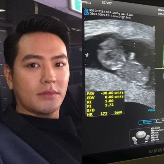 /사진=샵 장석현