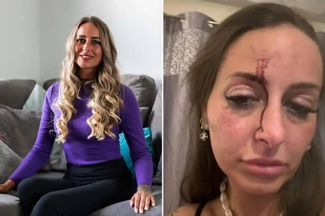 영국의 엠마 루이스 캘리(34)가 남자친구에게 폭행을 당하던 도중 애플의 음성비서 ‘시리’의 도움으로 극적으로 목숨을 구한 사연이 알려져 화제다. 더선 뉴시스