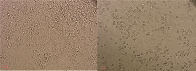 (왼쪽) 세포독성이 없는 생리대 처리군. 세포막이 매끄럽게 유지되며 정상적인 세포 성장이 관찰된다. (오른쪽) 세포독성이 관찰된 생리대 처리군. 세포막이 파열되고 소실되며, 비정상적인 세포 성장 양상이 나타난다. 성균관대 제공.