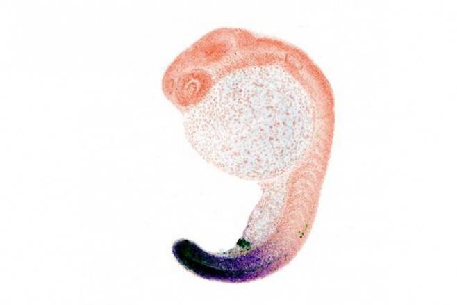 제브라피시 배아. 아래 쪽의 검은 부분이 총배설강 부위를 나타낸다. 하버드대 제공.