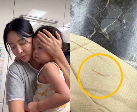 오른쪽 노란 동그라미 안에 생선 가시가 보인다./이지혜 인스타그램 캡처