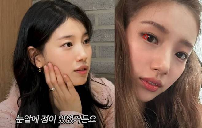 수지가 결막모반을 제거했다고 말했다. 사진=유튜브 채널 '조현아의 평범한 목요일 밤' 영상 캡처/수지 인스타그램