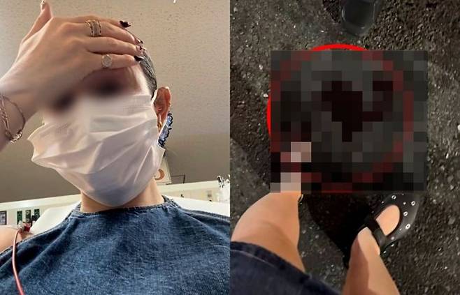 일본 도쿄 신주쿠 거리를 걷던 한 해외 관광객이 쥐에 물리는 사고를 당해 부상을 입었다. 인스타그램