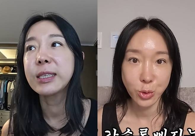 그룹 샵 출신 방송인 이지혜의 실 리프팅 시술 전후 모습. 유튜브 채널 ‘밉지 않은 관종언니’ 캡처