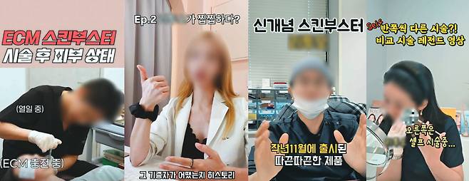 사체 조직에서 얻은 ‘인체유래 콜라겐’ ECM 스킨 부스터를 홍보하는 의사들. 인스타그램 캡처