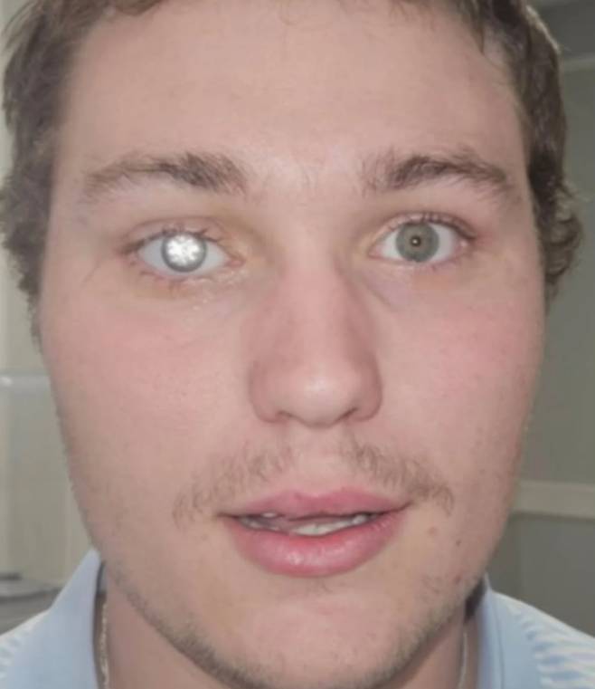 사진=artificialeyesbyjohnimm 인스타그램 캡처