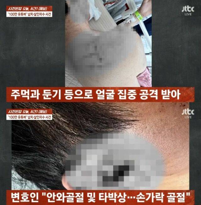 유튜버 수탉, 폭행 이후 모습 / JTBC '사건반장'