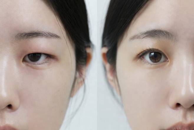 사진은 기사의 특정 내용과 관련 없음. 사진=게티이미지뱅크