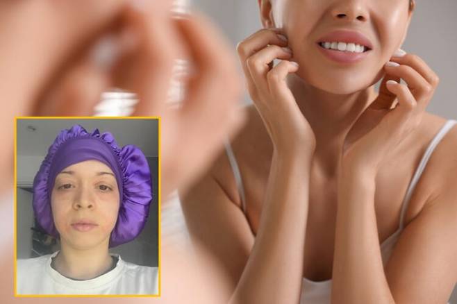 얼굴과 몸 전체에서 미세한 진드기가 '24시간 내내 기어 다니는 느낌'을 준다며 극심한 가려움과 작열감, 발진을 호소하는 30대 여성의 사연이 전해졌다. 배경사진=게티이미지뱅크 / 하단=크라우드펀딩