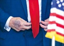 도널드 트럼프 미국 대통령의 손등에 멍이 들어 있다. /AFP연합뉴스