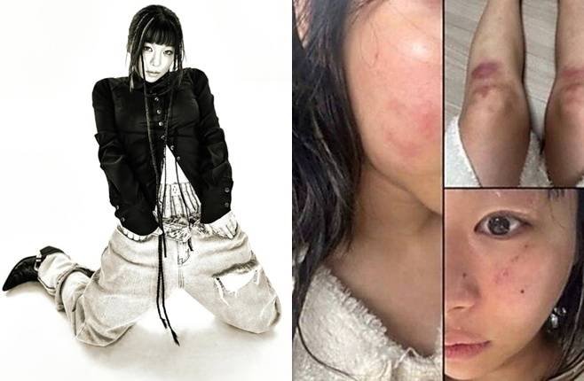 티브이데일리 포토