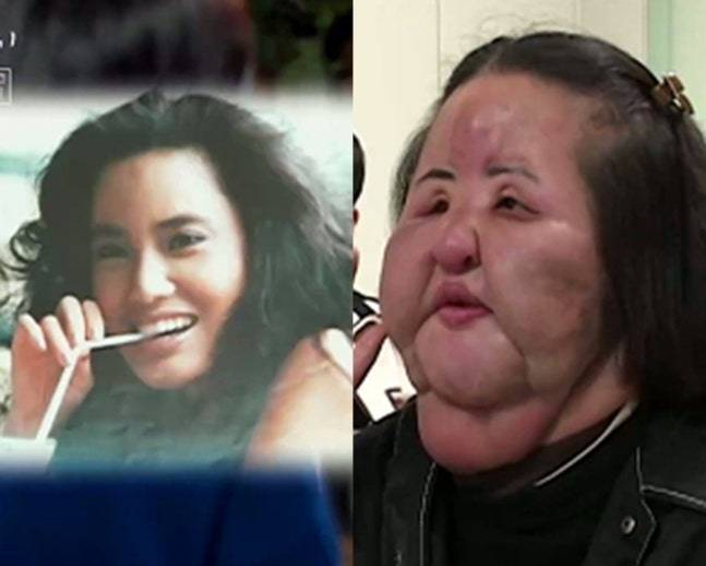 SBS ‘꼬리에 꼬리를 무는 그날 이야기’ 방송화면 캡처